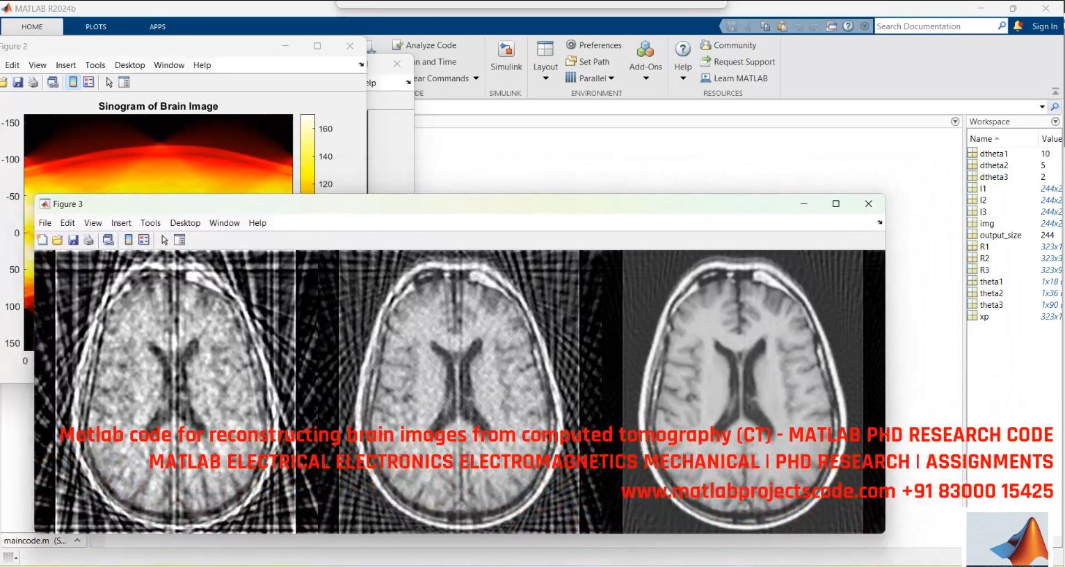 Brain Image Reconstruction from CT Scans - MATLAB Code for PhD Medical Imaging Research